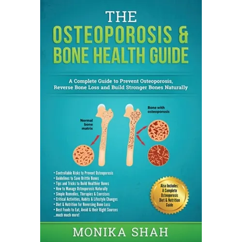 Osteoporosis: The Osteoporosis & Bone Health Guide: A Complete Guide to Prevent Osteoporosis, Reverse Bone Loss and Build Stronger Bones Naturally - Paperback
