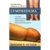 It's Not Just a Swelling! Lymphedema: Causes, Prevention, Treatment, Self-Management - Hardcover