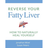 Reverse Your Fatty Liver: How To Naturally Heal Yourself - Paperback