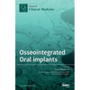 Osseointegrated Oral implants: Mechanisms of Implant Anchorage, Threats and Long-Term Survival Rates - Hardcover