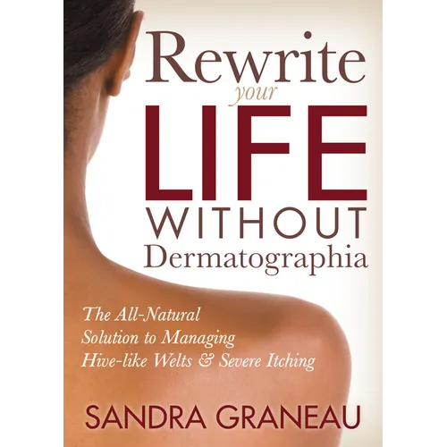 Rewrite Your Life Without Dermatographia: The All-Natural Solution to Managing Hive-Like Welts and Severe Itching - Paperback