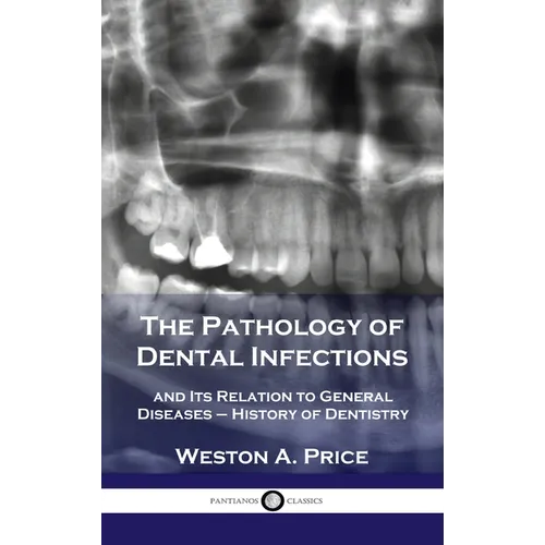 Pathology of Dental Infections: and Its Relation to General Diseases - History of Dentistry - Hardcover