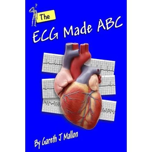 The ECG Made ABC - Paperback
