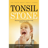Tonsil Stones: The Truth about Tonsil Stones (Eliminate Tonsil Stones and Have Fresh Breath in Just Days!) - Paperback