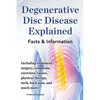 Degenerative Disc Disease Explained. Including Treatment, Surgery, Symptoms, Exercises, Causes, Physical Therapy, Neck, Back, Pain, and Much More! Fac - Paperback