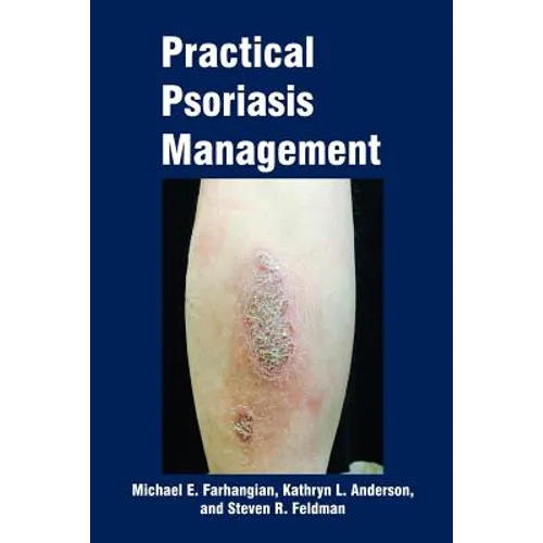 Practical Psoriasis Management - Paperback