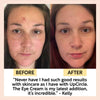 Eye Cream with Hyaluronic Acid & Coffee