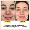 Face Scrub with Coffee + Rosehip Oil