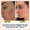 Cleanse, Tone + Moisturize Set