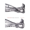 The Body Multiple: Ontology in Medical Practice - Paperback