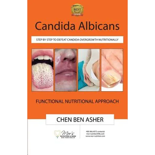 Candida Albicans: Step by Step to Defeat Candida Overgrowth Nutritionally - Paperback