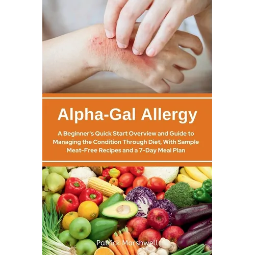 Alpha-Gal Allergy: A Beginner's Quick Start Overview and Guide to Managing the Condition Through Diet, with Sample Meat-Free Recipes and a 7-Day Meal - Paperback