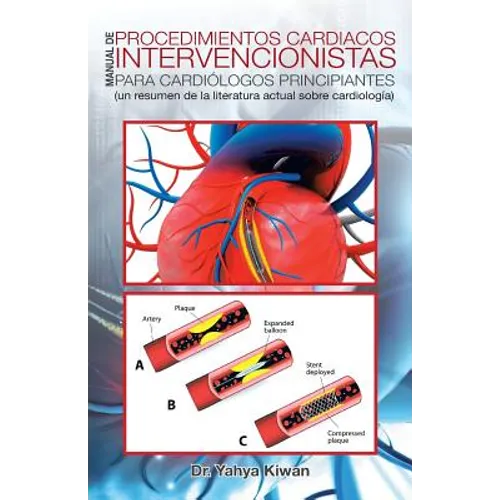 Manual de procedimientos cardiacos intervencionistas para cardiólogos principiantes: (un resumen de la literatura actual sobre cardiología) - Paperback