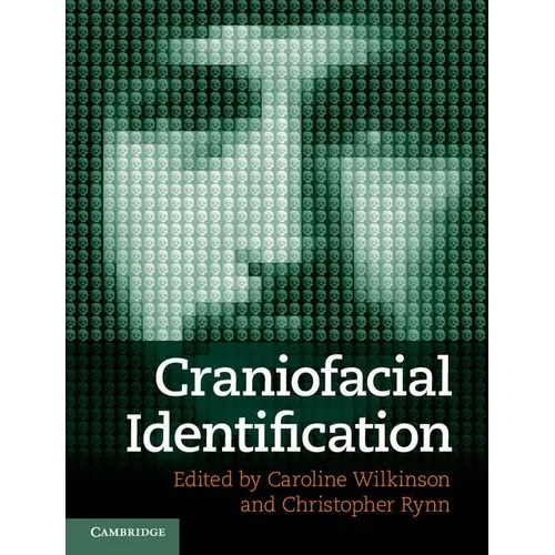 Craniofacial Identification - Hardcover