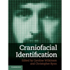 Craniofacial Identification - Hardcover