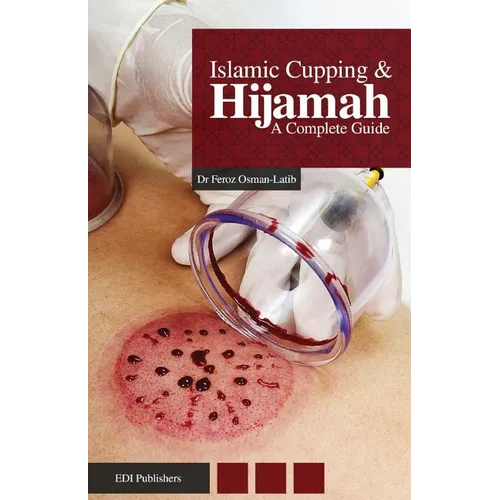 Islamic Cupping & Hijamah: A Complete Guide - Paperback