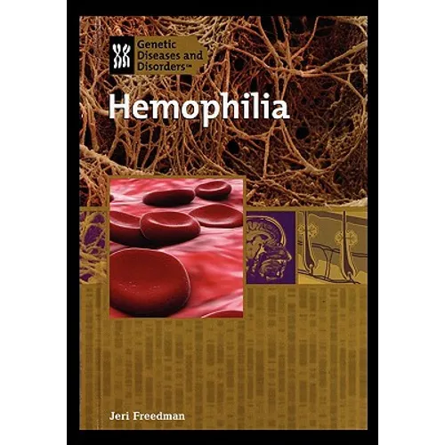 Hemophilia - Paperback