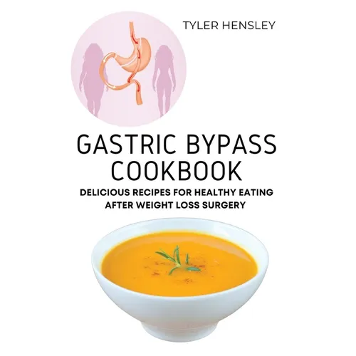 Gastric Bypass Cookbook: Delicious Recipes for Healthy Eating After Weight Loss Surgery - Paperback