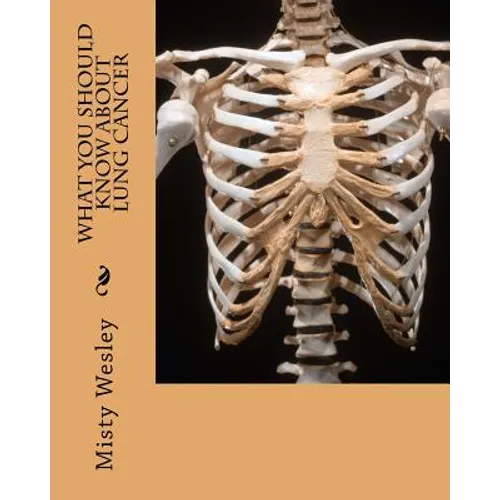 What you should know about Lung Cancer - Paperback