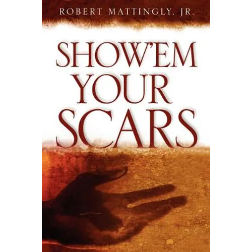 Show'em Your Scars - Paperback