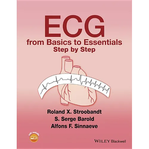 ECG from Basics to Essentials - Paperback