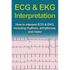 ECG & EKG Interpretation: How to interpret ECG & EKG, including rhythms, arrhythmias, and more! - Paperback