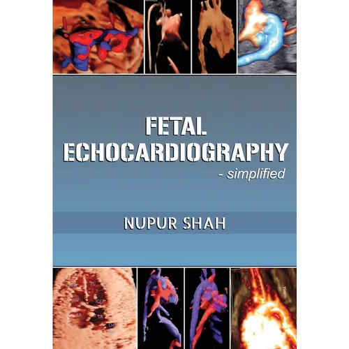 Fetal Echocardiography - Simplified - Paperback