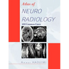 Atlas of Neuroradiology: 200 Common Cases - Paperback