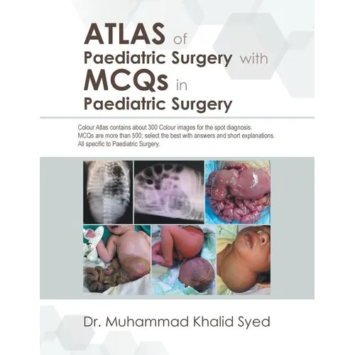 Atlas of Paediatric Surgery with Mcqs in Paediatric Surgery - Paperback