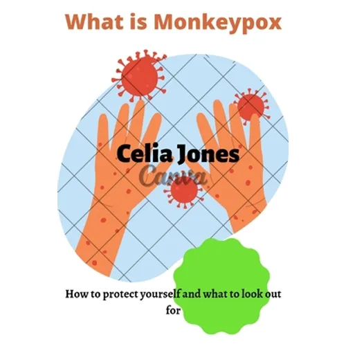 What Is Monkeypox: How to protect yourself and what to look out for. Guidelines for safety - Paperback