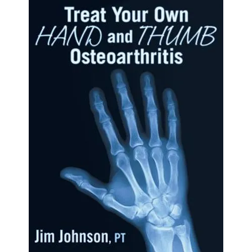 Treat Your Own Hand and Thumb Osteoarthritis - Paperback