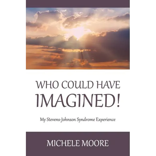Who Could Have Imagined!: My Stevens-Johnson Syndrome Experience - Paperback