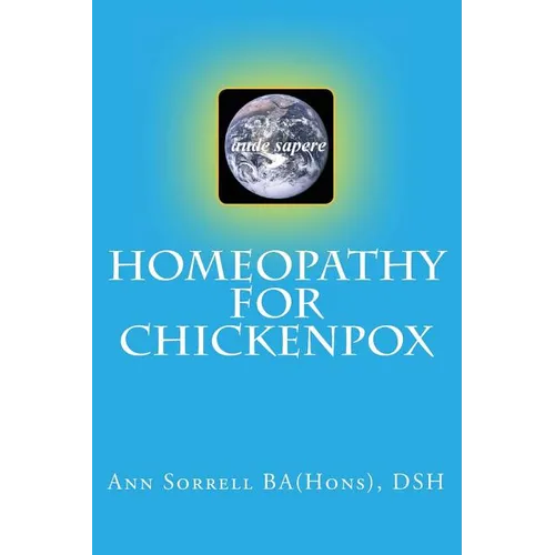 Homeopathy for Chickenpox - Paperback