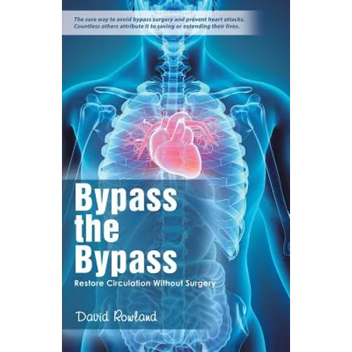 Bypass the Bypass: Restore Circulation Without Surgery - Paperback