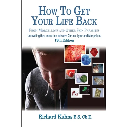 How to Get Your Life Back From Morgellons and Other Skin Parasites Limited Edit - Paperback