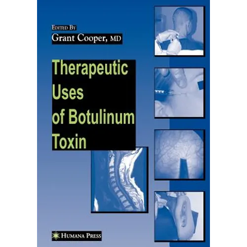 Therapeutic Uses of Botulinum Toxin - Paperback
