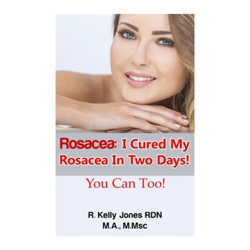 Rosacea: I Cured My Rosacea In Two Days! You Can Too! - Paperback