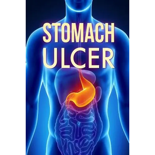 Stomach Ulcer: Treatment in 60 days!: Stomach Ulcer treatment - Paperback