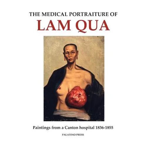 The Medical Portraiture of Lam Qua: Paintings from a Canton hospital 1836-1855 - Paperback