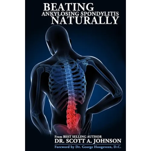 Beating Ankylosing Spondylitis Naturally - Paperback