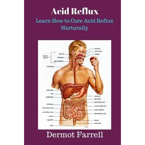 Acid Reflux: Learn How to Cure Acid Reflux Naturally - Paperback