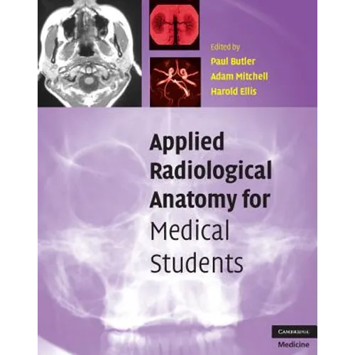 Applied Radiological Anatomy for Medical Students - Paperback