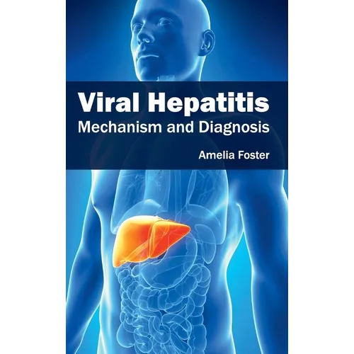 Viral Hepatitis: Mechanism and Diagnosis - Hardcover