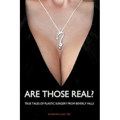 Are Those Real?: True Tales of Plastic Surgery from Beverly Hills - Hardcover