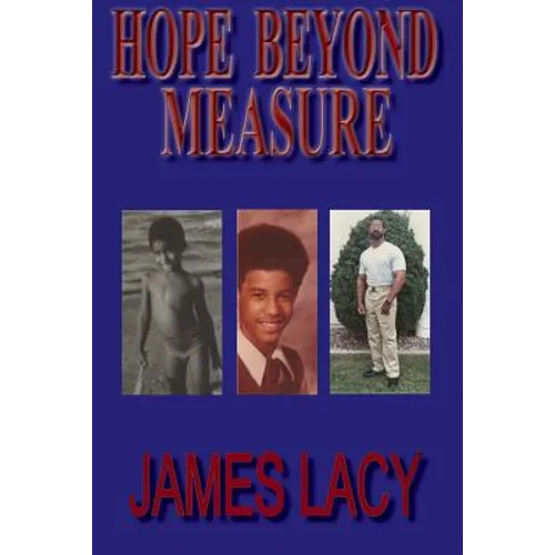 Hope Beyond Measure - Paperback