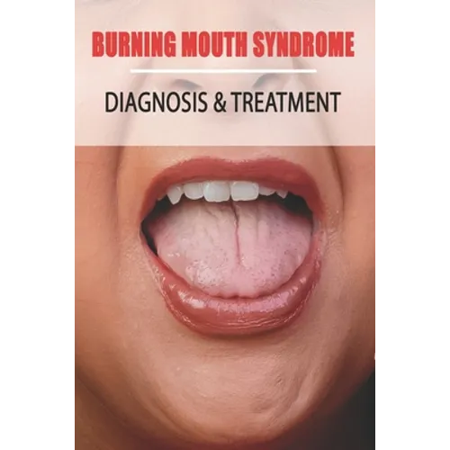 Burning Mouth Syndrome: Diagnosis & Treatment: Burning Mouth Syndrome Guide - Paperback