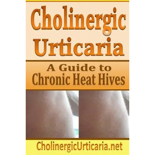 Cholinergic Urticaria: A Guide to Chronic Heat Hives - Paperback