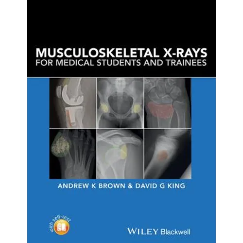 Musculoskeletal X-Rays for Medical Students and Trainees - Paperback