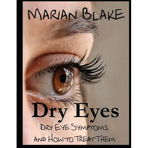 Dry Eyes (Large Print): Dry Eye Symptoms and how to treat them - Paperback