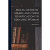 Moles, or Birth-marks, and Their Signification to Man and Woman - Paperback